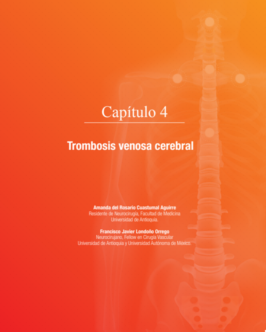 Trombosis venosa cerebral