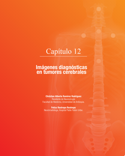 Imágenes diagnósticas en tumores cerebrales